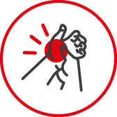 Oparzenia 1. stopnia